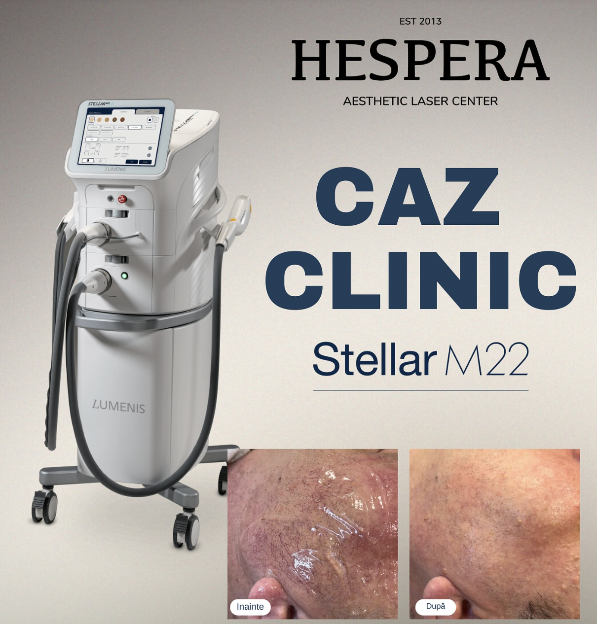 Tehnologia care redefinește standardele în rejuvenarea pielii Stellar M22